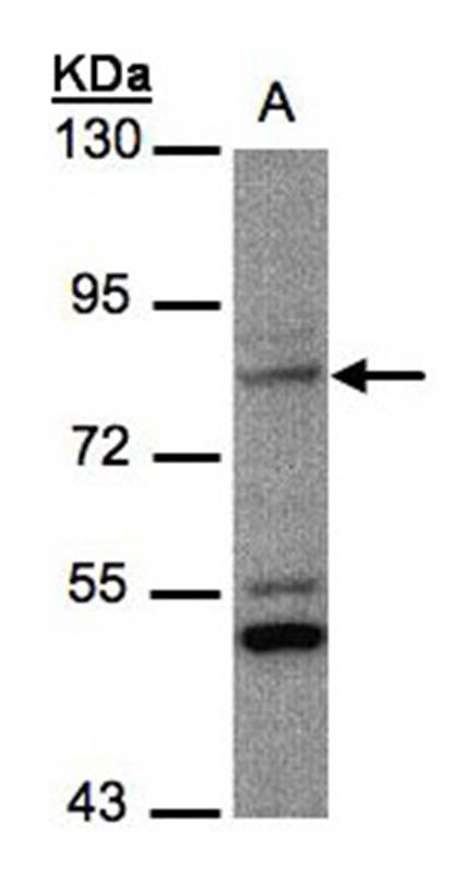 phosphate-regulating neutral endopeptidase antibody