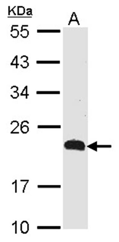 CKLFSF5 antibody