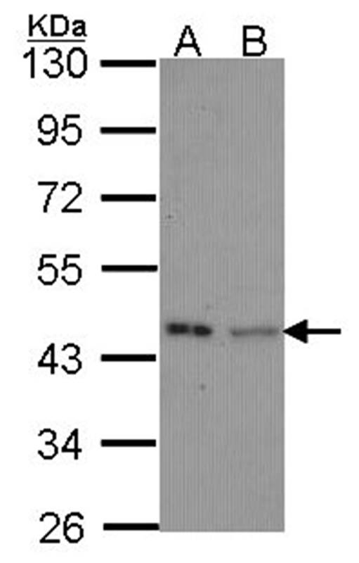 IVD antibody