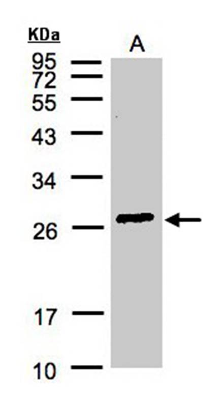 glutathione S-transferase alpha 2 antibody