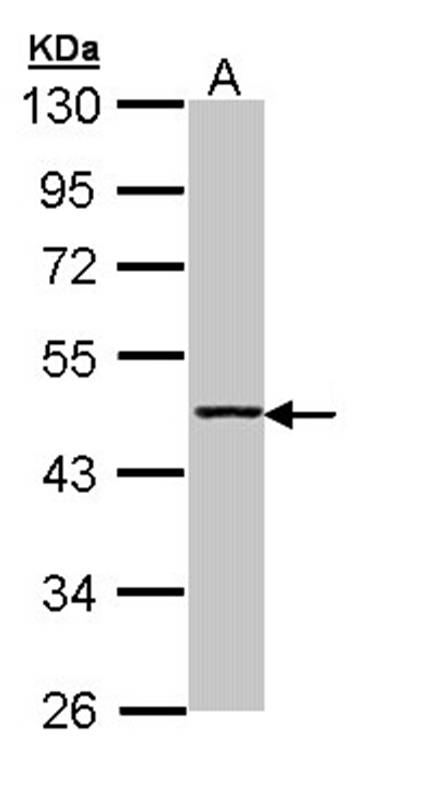 Aminoacylase antibody