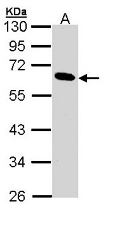 Pancreatic Lipase antibody