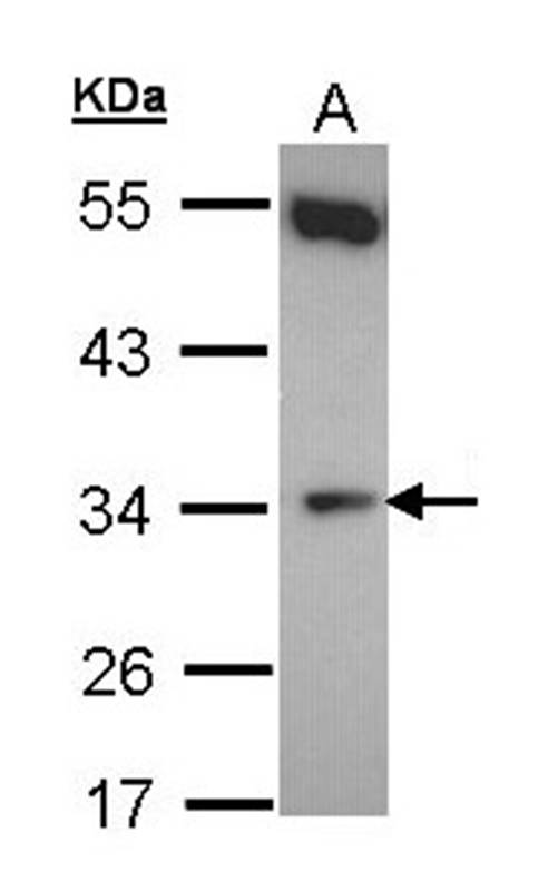 b5R.1 antibody