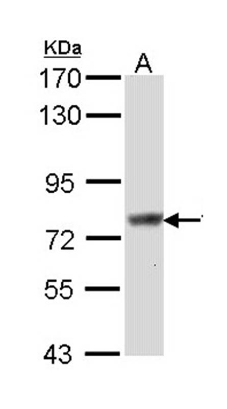 Scinderin antibody