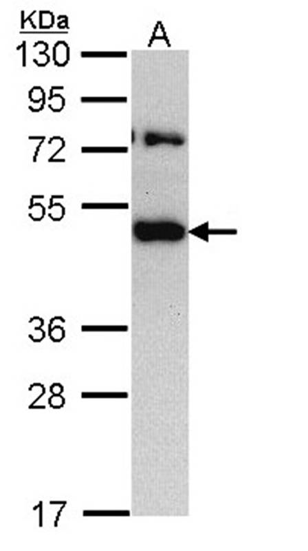 translocation associated membrane protein 1 antibody
