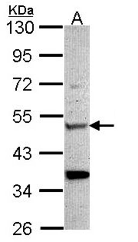 Chitotriosidase antibody
