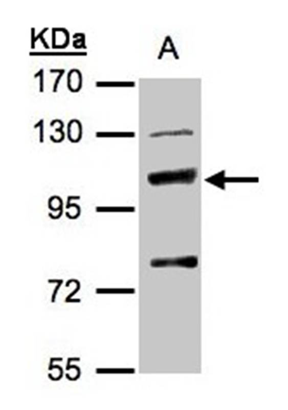 MANBA antibody