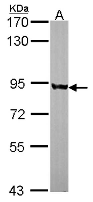PNPase antibody