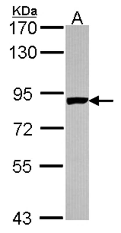 PNPase antibody
