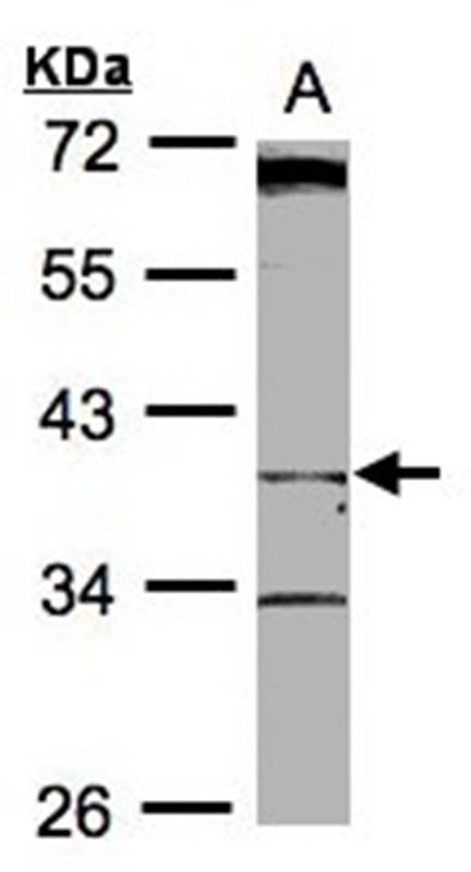 BHMT2 antibody