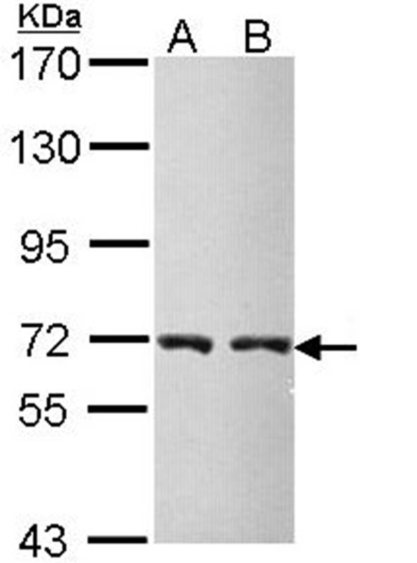 CBS antibody