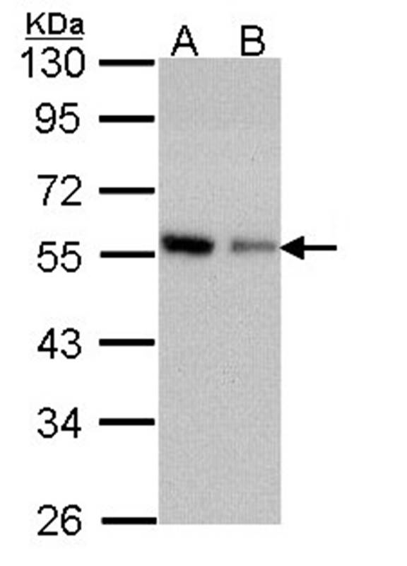 Coronin 3 antibody