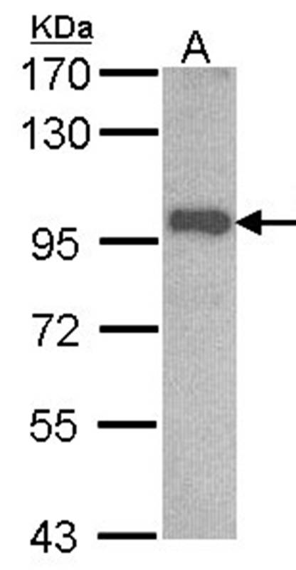 OSBPL6 antibody
