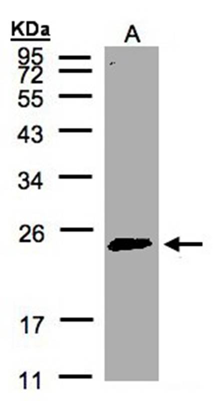 Rab 2 antibody