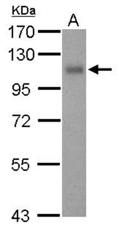 Thrombomodulin(CD141) antibody