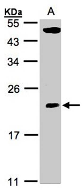 CGI21 antibody