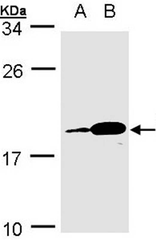 PACAP antibody