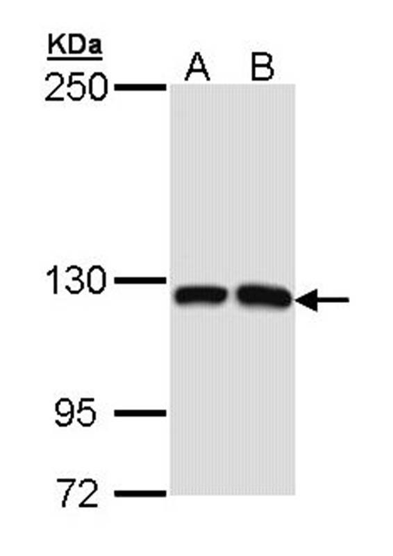Dbs antibody