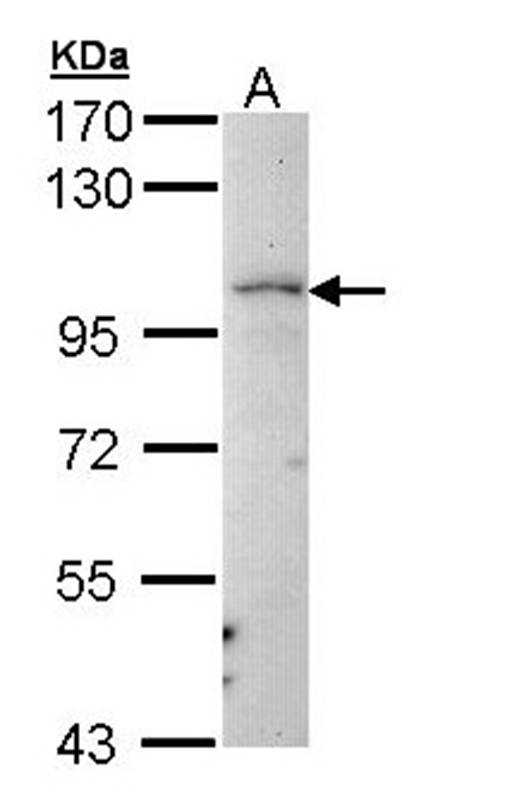 LARS2 antibody