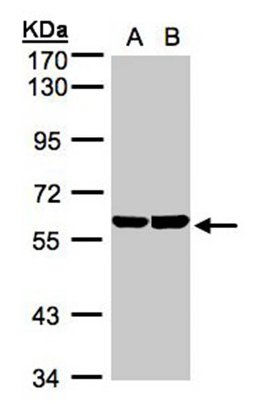 cell cycle progression 2 protein isoform 2 antibody