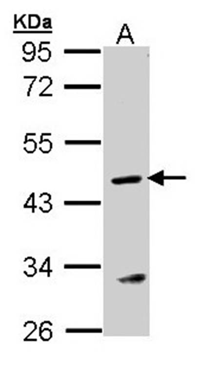Argininosuccinate Lyase antibody
