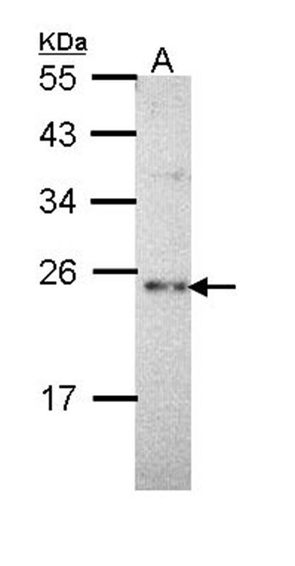 calcium binding protein P22 antibody