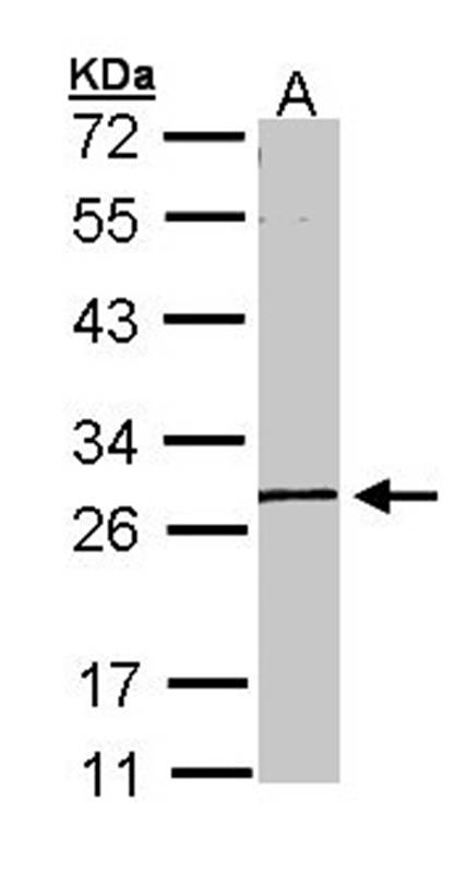 MGC40579 antibody