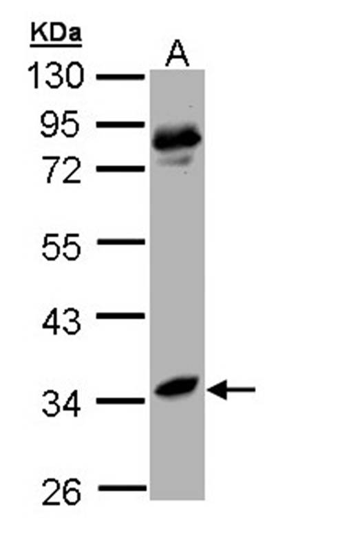 arginase I antibody