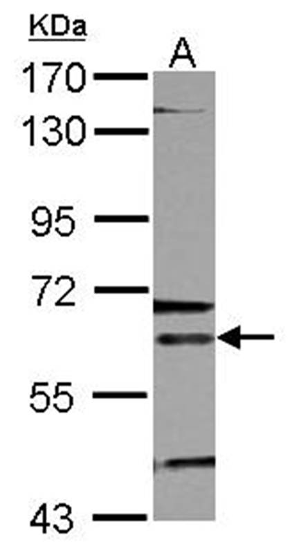 ALAS-E antibody