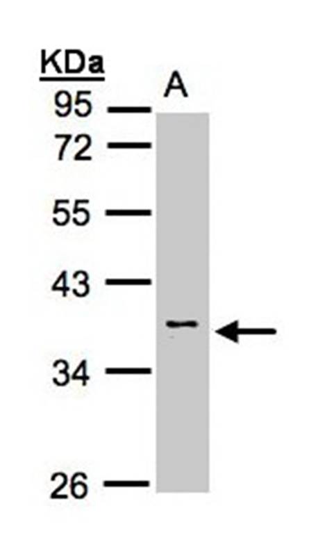 Calsequestrin-2 antibody