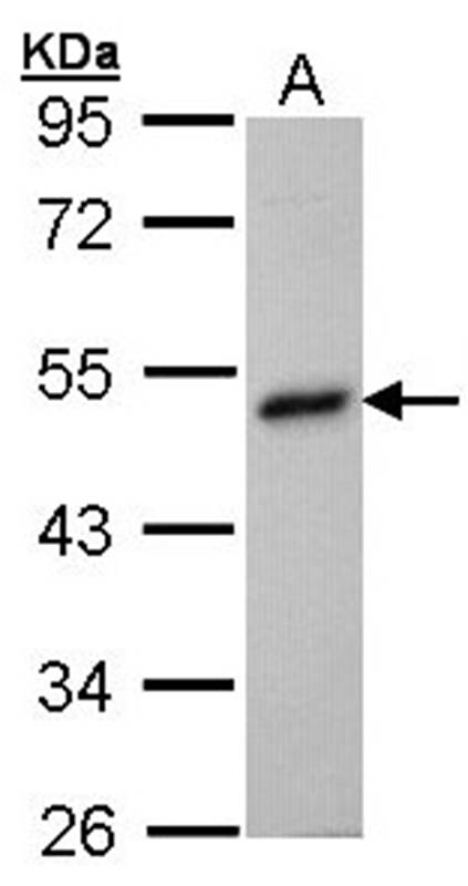 betaine-homocysteine methyltransferase antibody