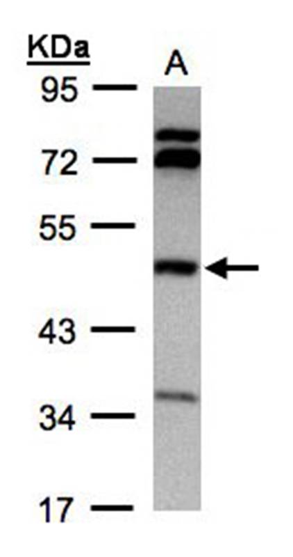 betaine-homocysteine methyltransferase antibody