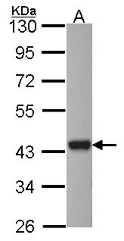 ARSA antibody
