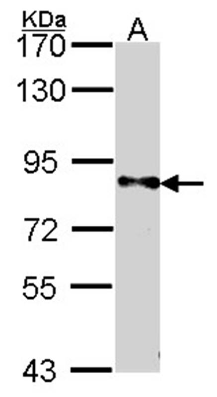 DPYD antibody