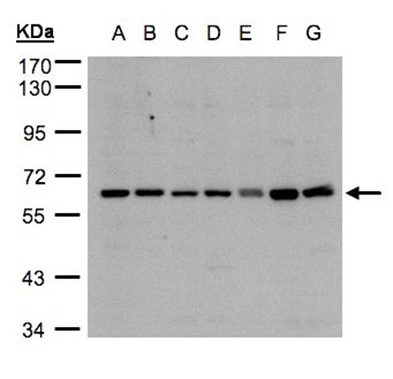 CYP24A1 antibody