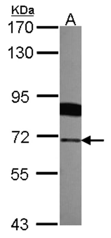 Radixin antibody