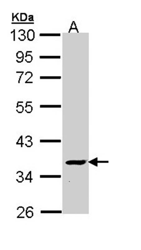 V-ATPase C2 antibody
