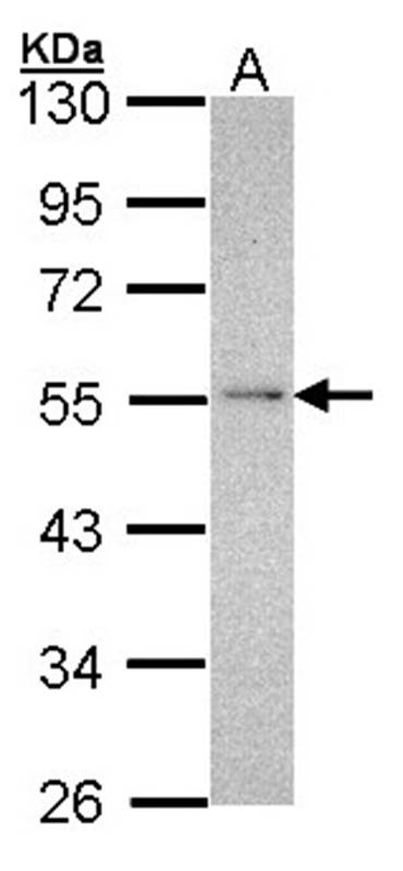 NDUFV1 antibody