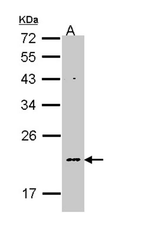 NDUFB5 antibody