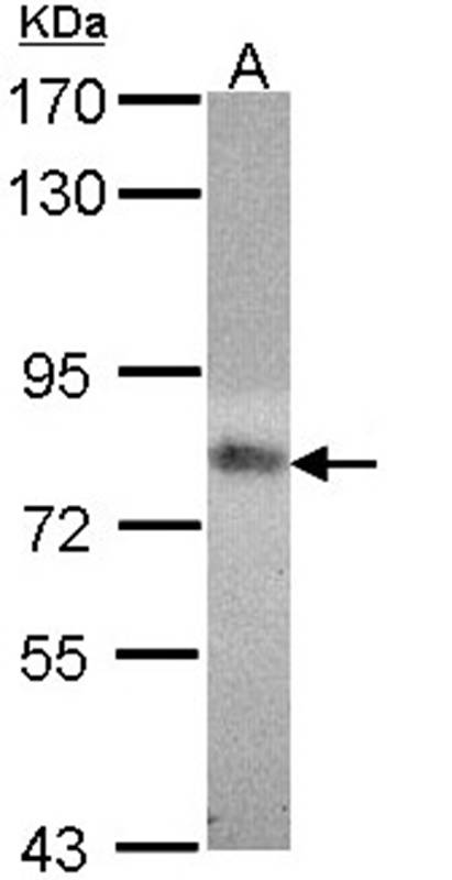 MTHFR antibody