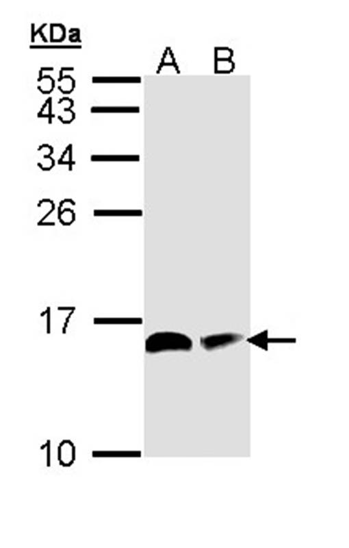 ACP antibody