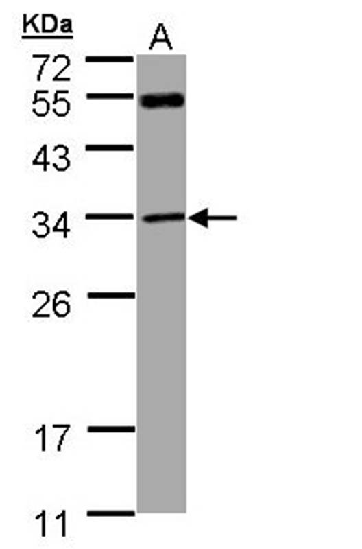 MTAP antibody