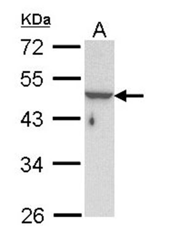 KRTHA3B antibody