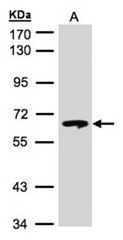 beta-glucosidase antibody