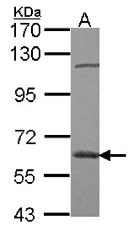 beta-glucosidase antibody
