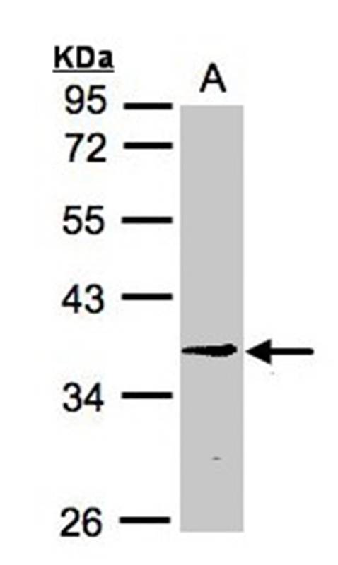 BXDC1 antibody