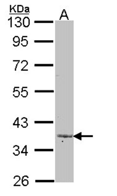 Lefty -A antibody