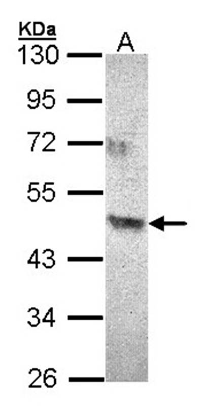 ACAD8 antibody