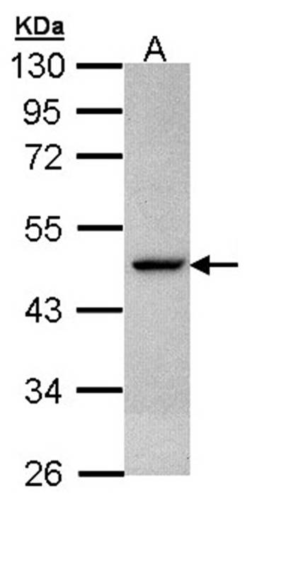 Citrate synthetase antibody