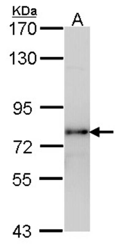 LHR antibody